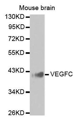 Western blot analysis of extracts of Mouse brain using VEGFC antibody