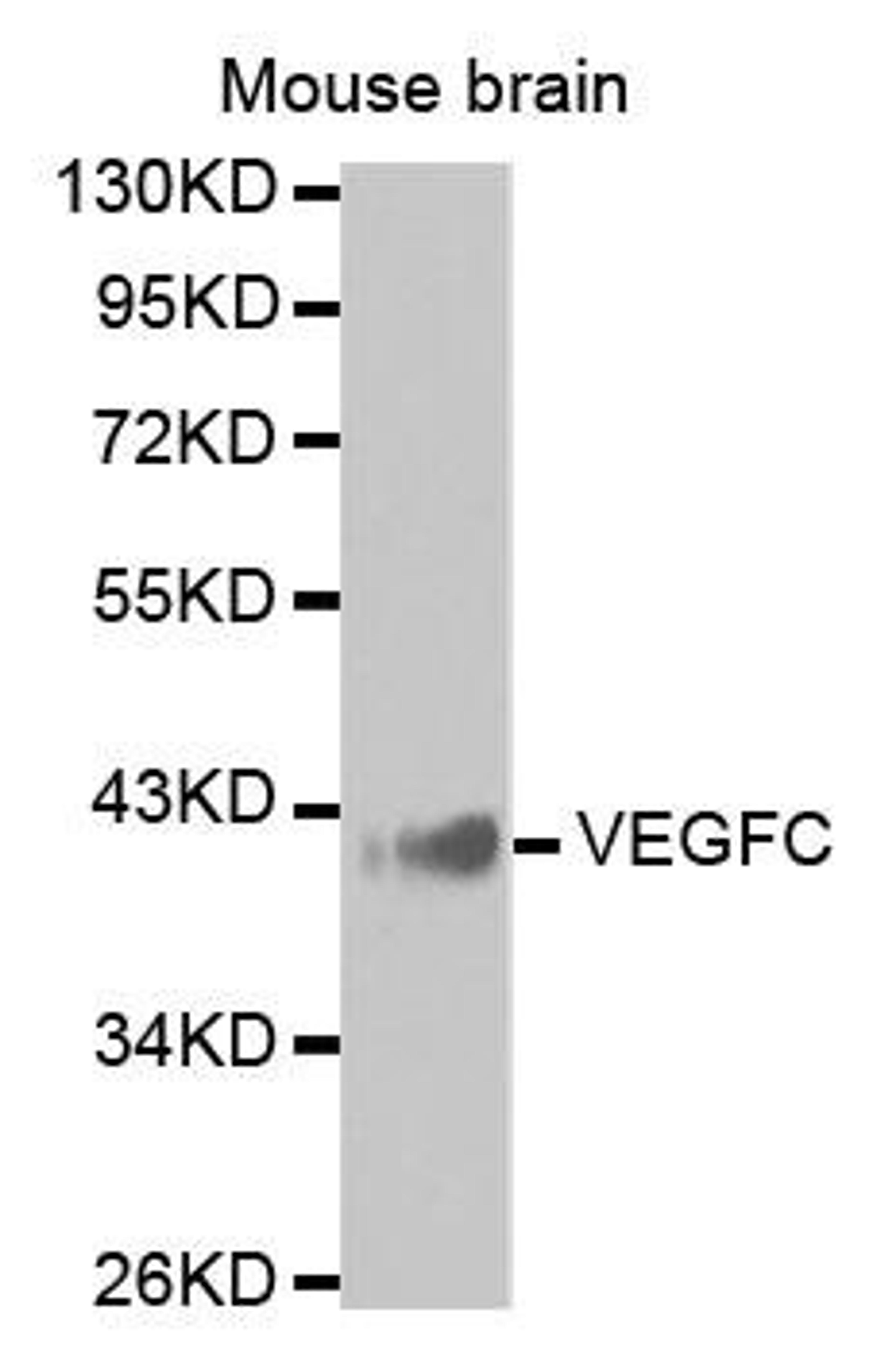 Western blot analysis of extracts of Mouse brain using VEGFC antibody