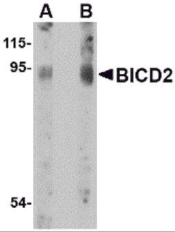Western blot analysis of BICD2 in A549 cell lysate with BICD2 antibody at (A) 1 and (B) 2 μg/mL.