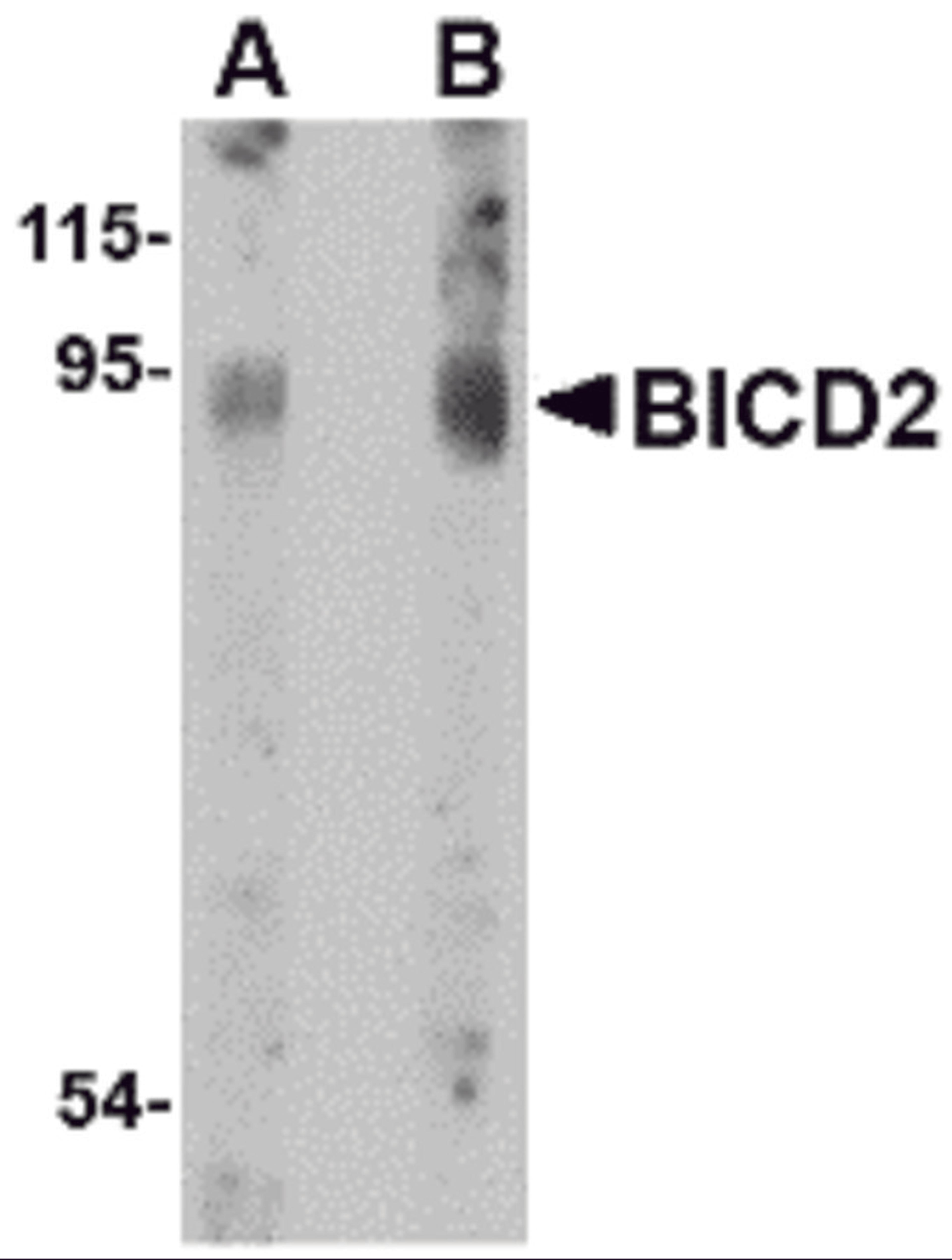Western blot analysis of BICD2 in A549 cell lysate with BICD2 antibody at (A) 1 and (B) 2 μg/mL.