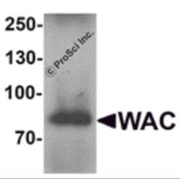 Western blot analysis of WAC in human testis tissue lysate with WAC antibody at 1 &#956;g/mL.