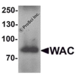 Western blot analysis of WAC in human testis tissue lysate with WAC antibody at 1 μg/mL.