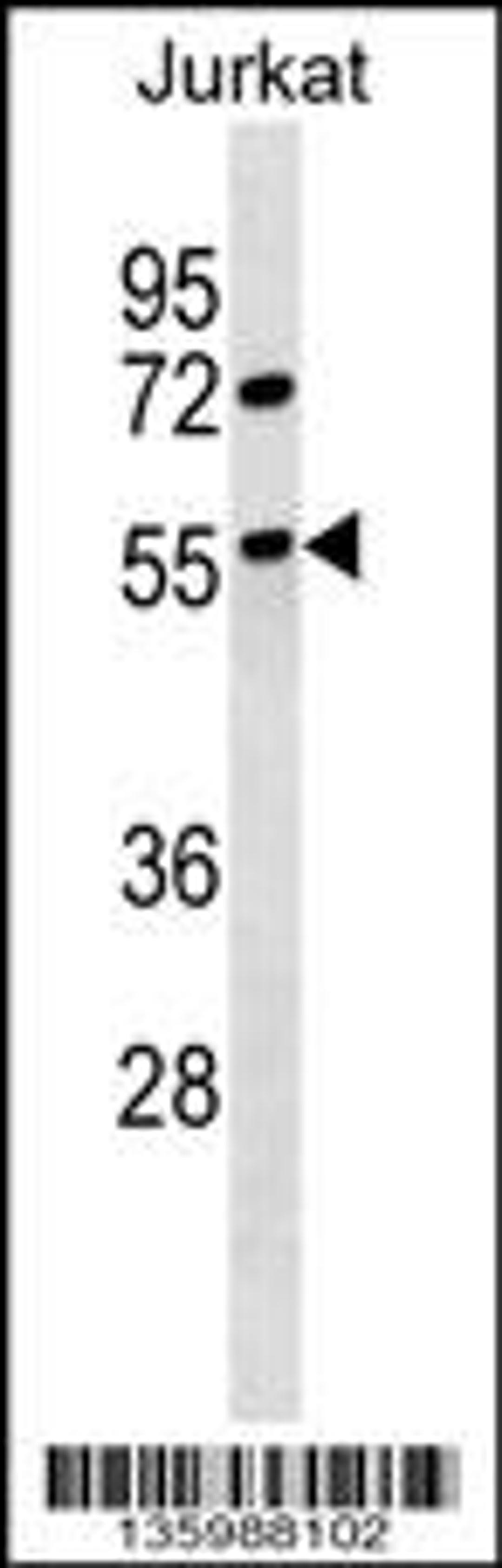 Western blot analysis in Jurkat cell line lysates (35ug/lane).