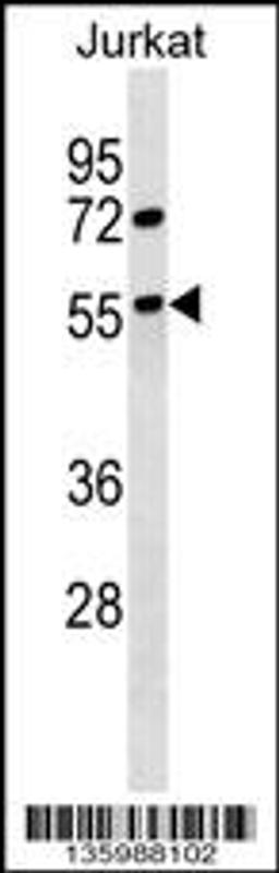 Western blot analysis in Jurkat cell line lysates (35ug/lane).