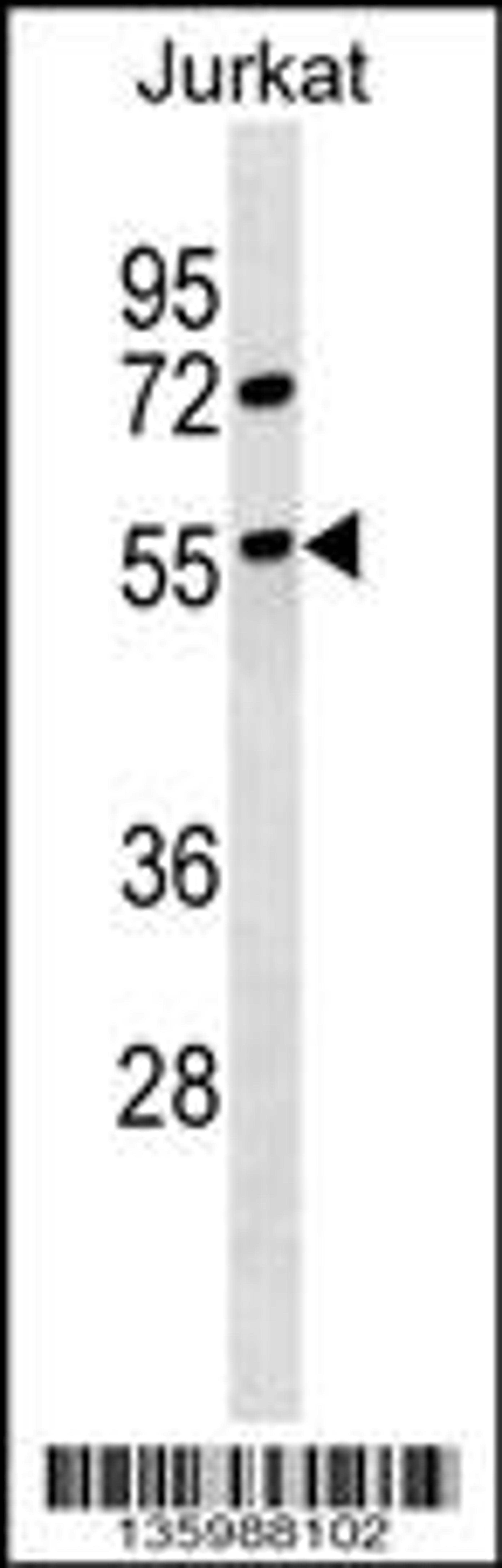 Western blot analysis in Jurkat cell line lysates (35ug/lane).