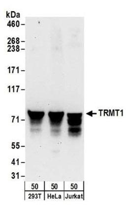 Detection of human TRMT1 by western blot.