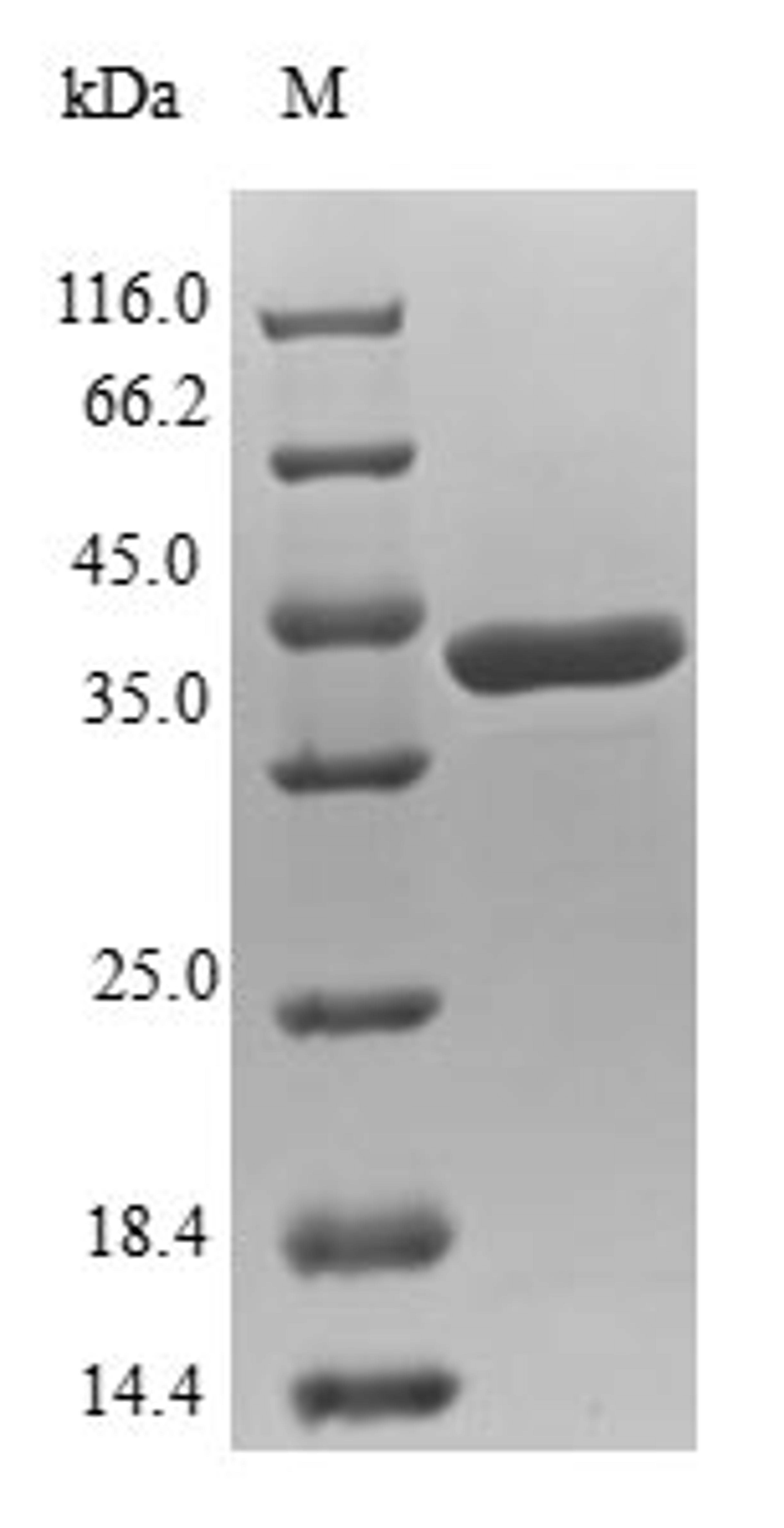 (Tris-Glycine gel) Discontinuous SDS-PAGE (reduced) with 5% enrichment gel and 15% separation gel.