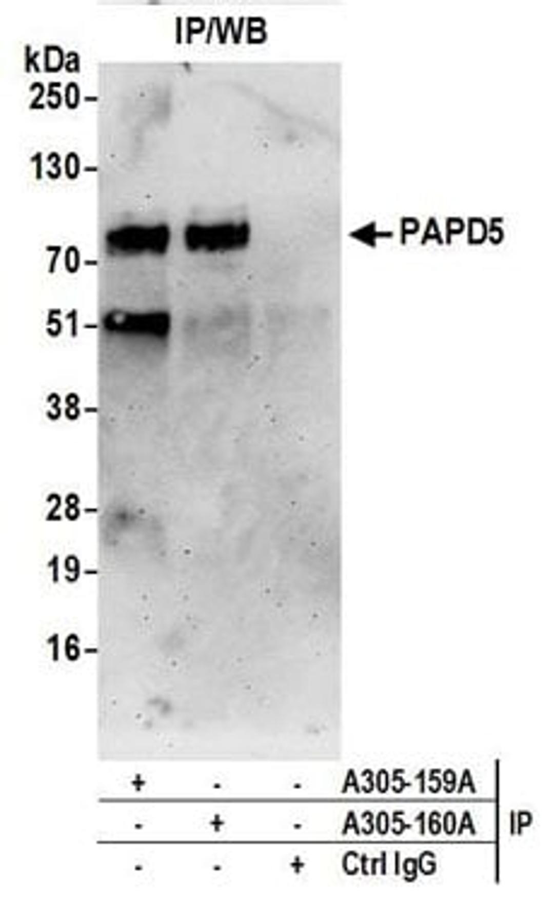 Detection of human PAPD5 by western blot of immunoprecipitates.