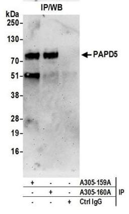 Detection of human PAPD5 by western blot of immunoprecipitates.