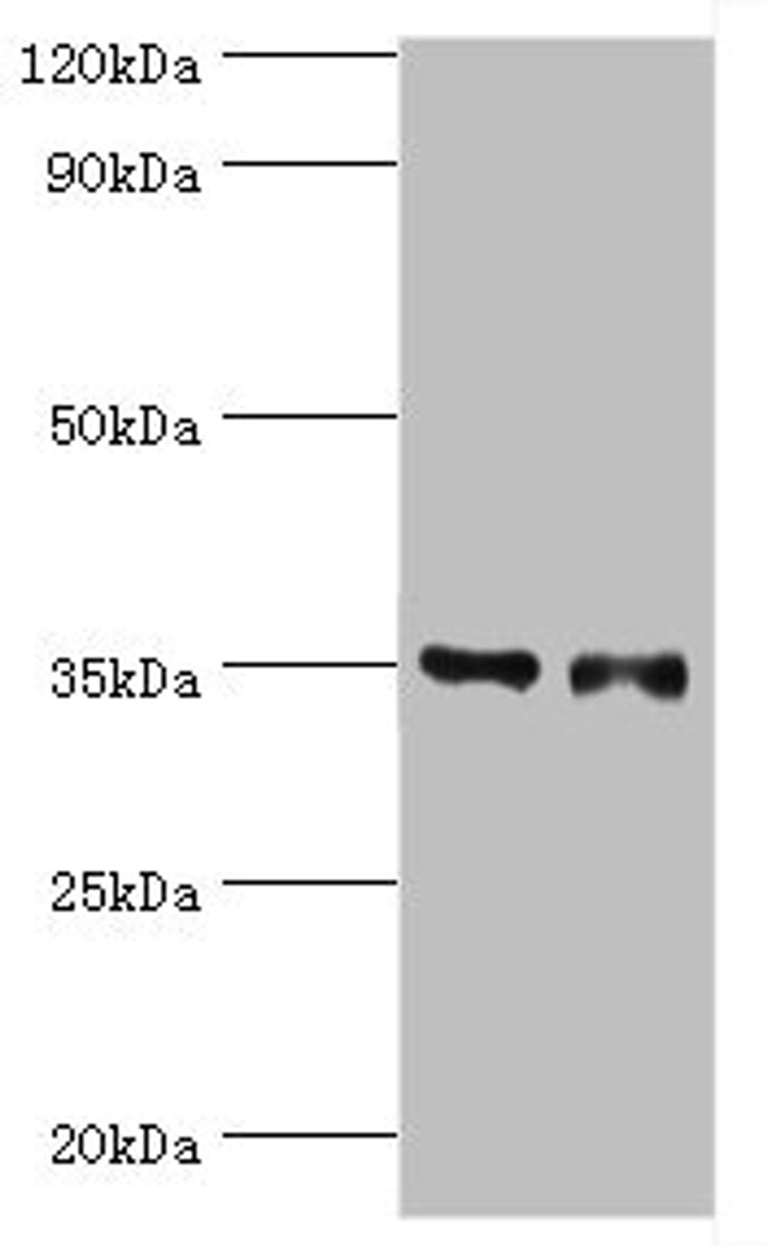 Western blot. All lanes: Estrogen sulfotransferase antibody at 7ug/ml. Lane 1: Mouse lung tissue. Lane 2: Mouse liver tissue. Secondary. Goat polyclonal to rabbit IgG at 1/10000 dilution. Predicted band size: 35, 30 kDa. Observed band size: 35 kDa.