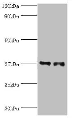 Western blot. All lanes: Estrogen sulfotransferase antibody at 7ug/ml. Lane 1: Mouse lung tissue. Lane 2: Mouse liver tissue. Secondary. Goat polyclonal to rabbit IgG at 1/10000 dilution. Predicted band size: 35, 30 kDa. Observed band size: 35 kDa.
