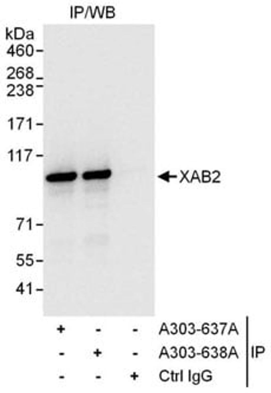 Detection of human XAB2 by western blot of immunoprecipitates.