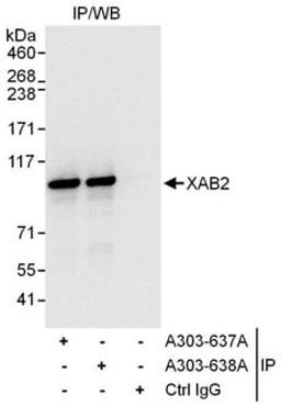 Detection of human XAB2 by western blot of immunoprecipitates.