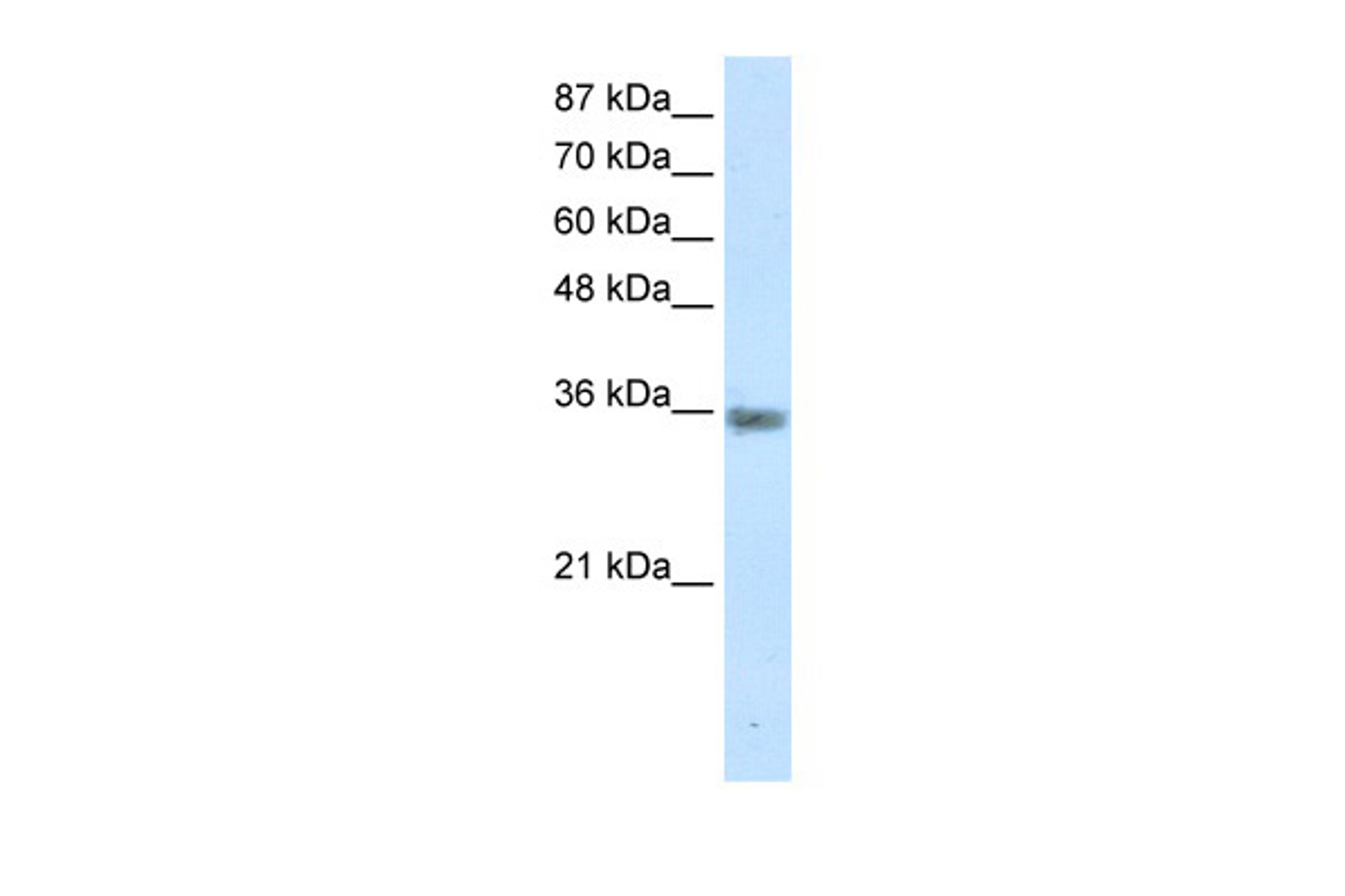 Antibody used in WB on Human Jurkat 1.25 ug/ml.