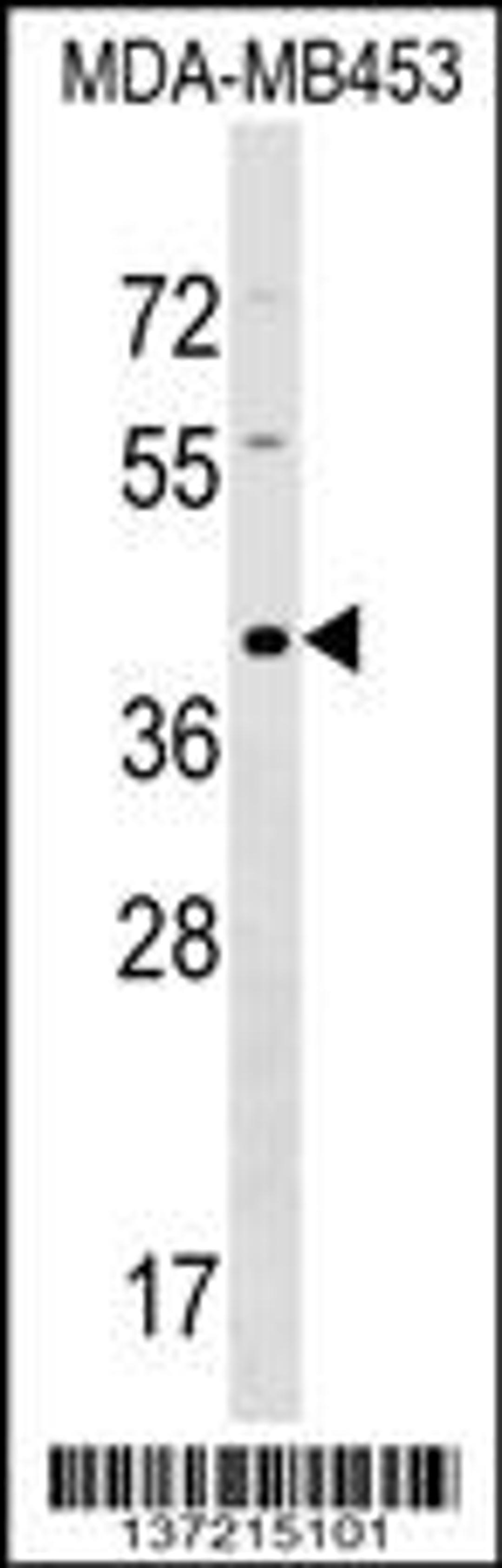 Western blot analysis in MDA-MB453 cell line lysates (35ug/lane).