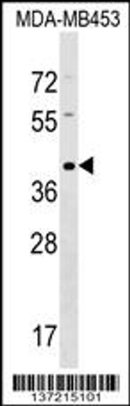 Western blot analysis in MDA-MB453 cell line lysates (35ug/lane).