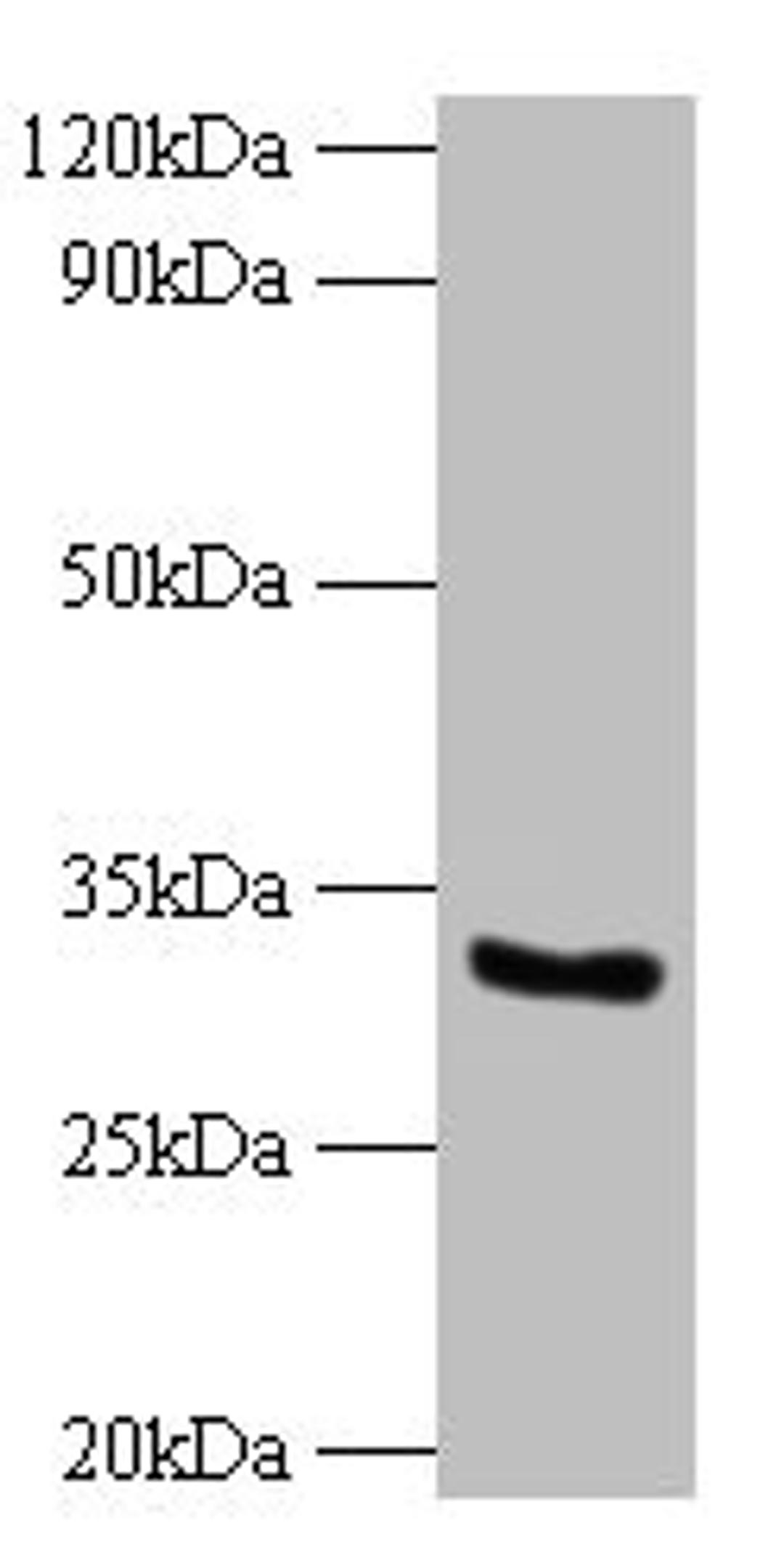 Western blot. All lanes: CYB5R3 antibody at 2µg/ml + 293T whole cell lysate. Secondary. Goat polyclonal to rabbit IgG at 1/10000 dilution. Predicted band size: 35, 32, 39 kDa. Observed band size: 32 kDa