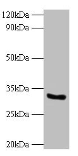 Western blot. All lanes: CYB5R3 antibody at 2µg/ml + 293T whole cell lysate. Secondary. Goat polyclonal to rabbit IgG at 1/10000 dilution. Predicted band size: 35, 32, 39 kDa. Observed band size: 32 kDa