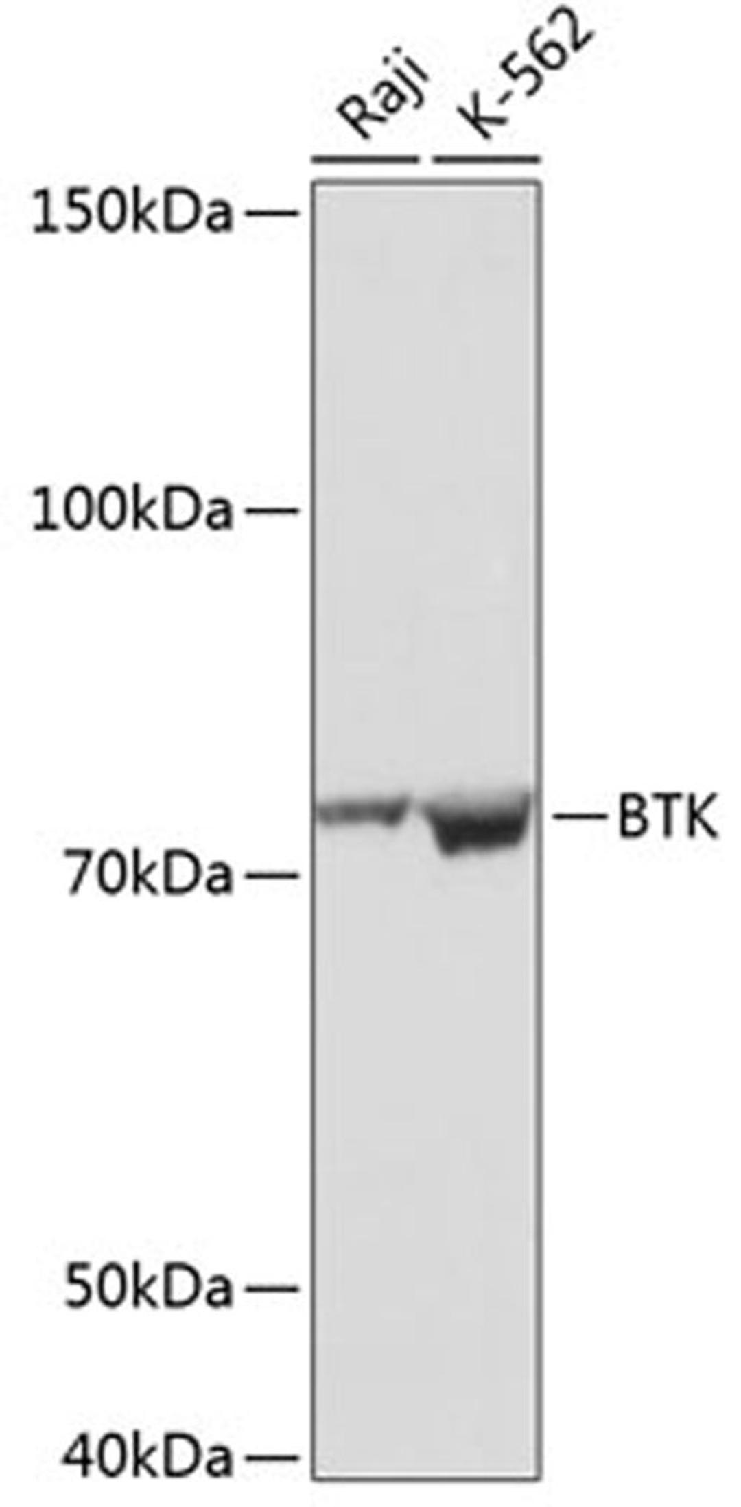 Western blot - BTK antibody (A19002)