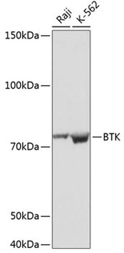 Western blot - BTK antibody (A19002)