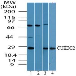 Western Blot: CUEDC2 Antibody [NBP2-24639] - analysis of CUEDC2 in MCF7 cell lysate in the 1) absence and 2) presence of immunizing peptide, 3) NIH 3T3 cell lysate, and 4) human spleen cell lysate using this antibody. 5 ug/ml.