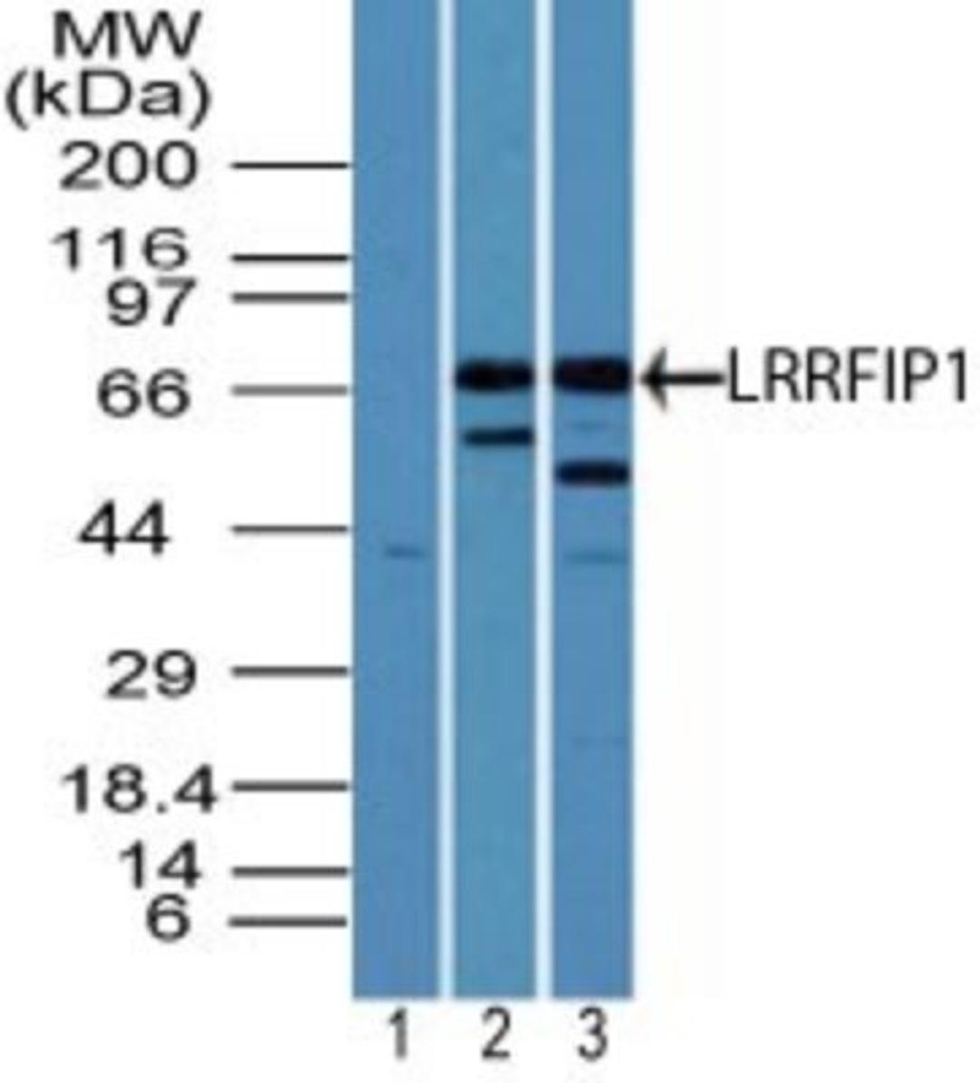 Western Blot: LRRFIP1 Antibody [NBP2-24672] - Analysis of LRRFIP1 in human heart lysate using 1) pre-bleed and 2) NBP2-24672, and NBP2-24672 in 3) mouse heart lysate at 3 and 5 ug/ml, respectively. Goat anti-rabbit Ig HRP secondary antibody and PicoTect ECL substrate solution were used for this test.