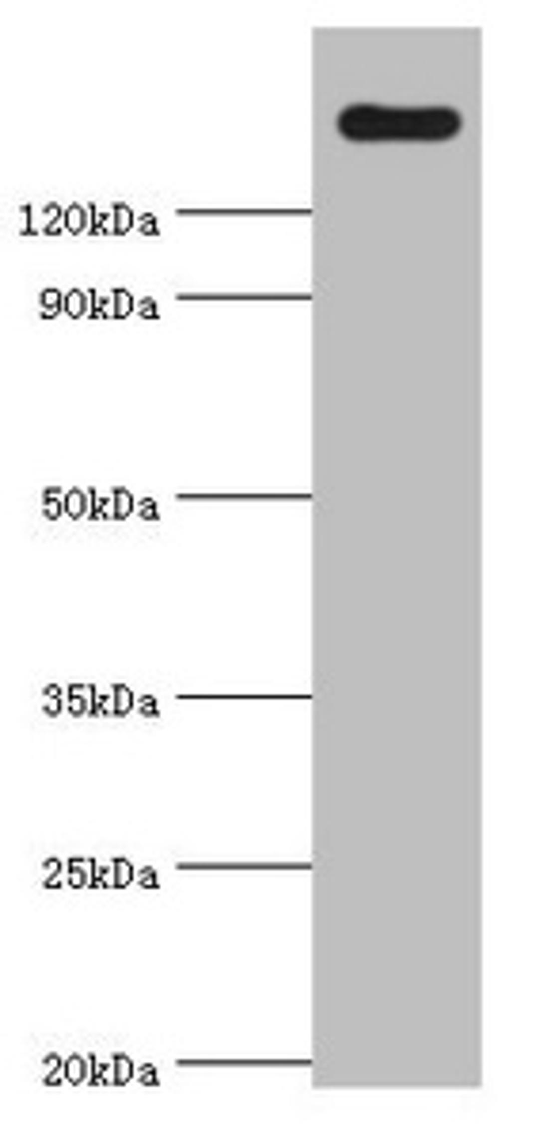 Western blot. All lanes: CARD11 antibody at 4µg/ml + K562 whole cell lysate. Secondary. Goat polyclonal to rabbit IgG at 1/10000 dilution. Predicted band size: 133 kDa. Observed band size: 133 kDa
