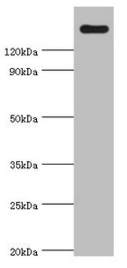 Western blot. All lanes: CARD11 antibody at 4µg/ml + K562 whole cell lysate. Secondary. Goat polyclonal to rabbit IgG at 1/10000 dilution. Predicted band size: 133 kDa. Observed band size: 133 kDa