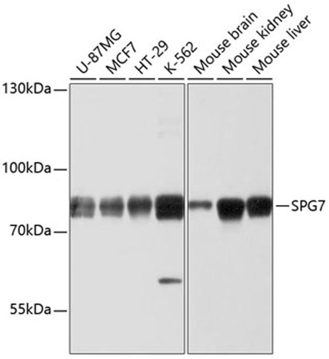 Western blot - SPG7 antibody (A10249)