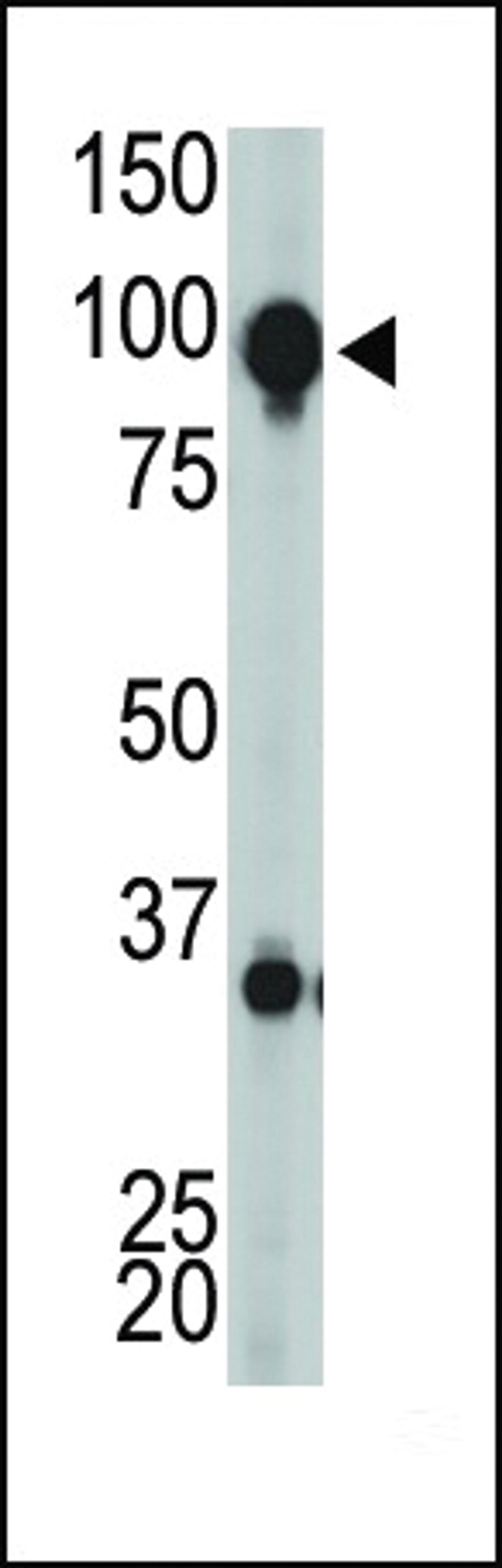 Antibody is used in Western blot to detect GRPRC1H in mouse brain tissue lysate.