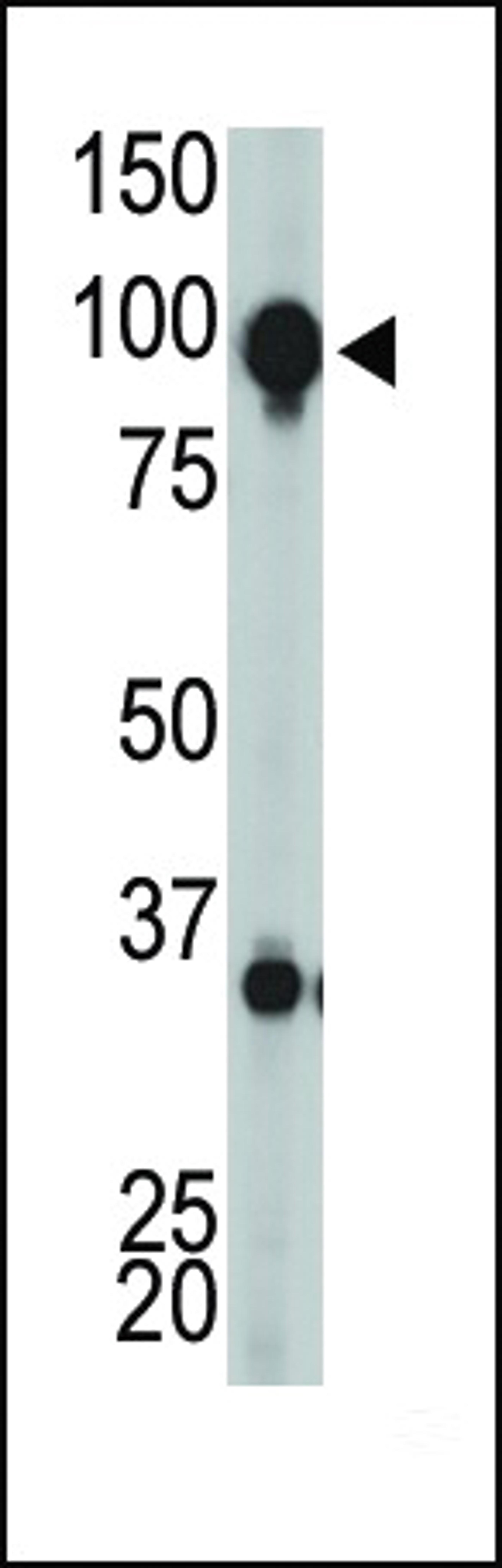 Antibody is used in Western blot to detect GRPRC1H in mouse brain tissue lysate.