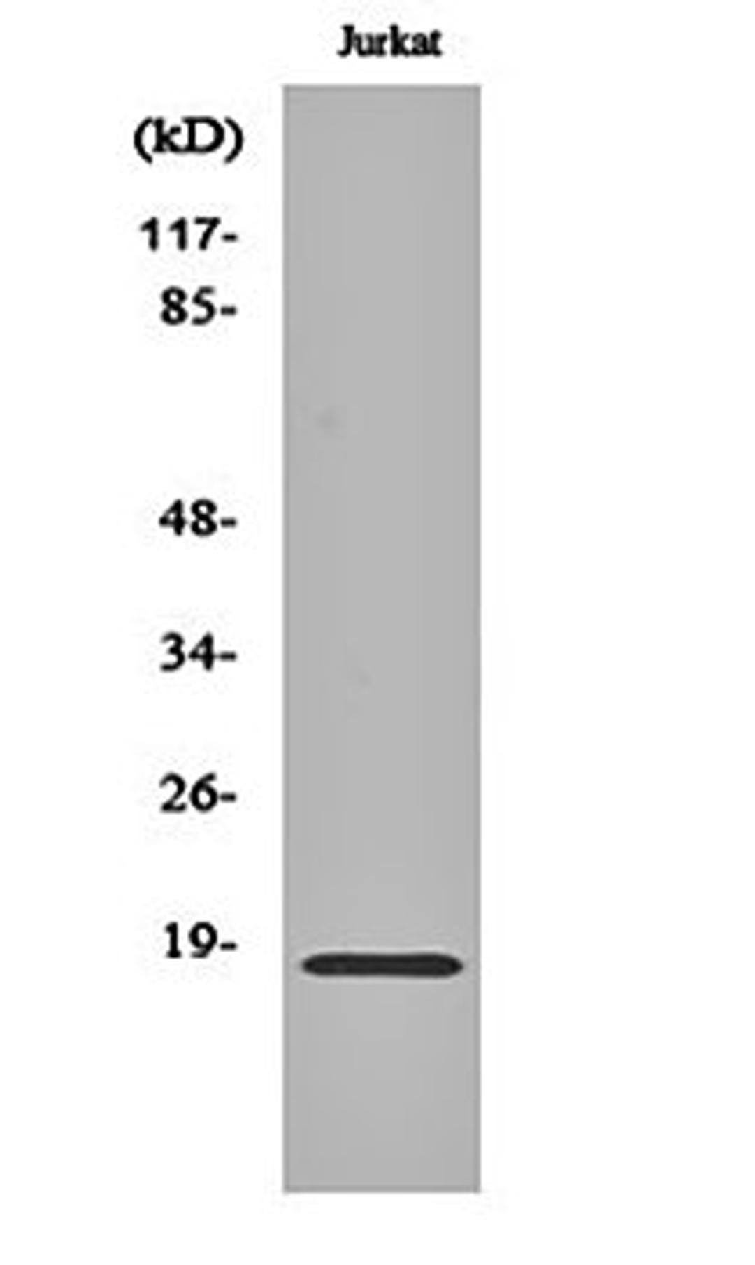 Western blot analysis of Jurkat cell lysates using Neuromedin-S antibody