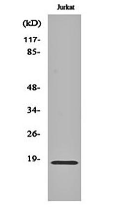 Western blot analysis of Jurkat cell lysates using Neuromedin-S antibody