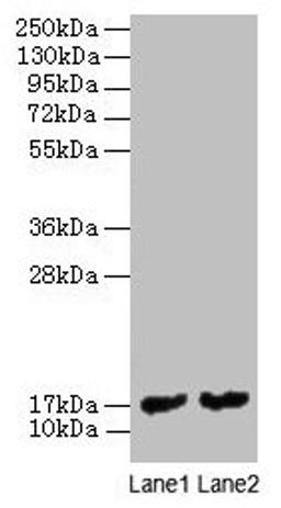Western blot. All lanes: mpt63 antibody at 2µg/ml. Lane 1: Recombinant Mycobacterium tuberculosis Immunogenic protein MPT63 protein 1µg. Lane 2: Recombinant Mycobacterium tuberculosis Immunogenic protein MPT63 protein 0.1µg. Secondary. Goat polyclonal to rabbit IgG at 1/10000 dilution. Predicted band size: 17 kDa. Observed band size: 17 kDa