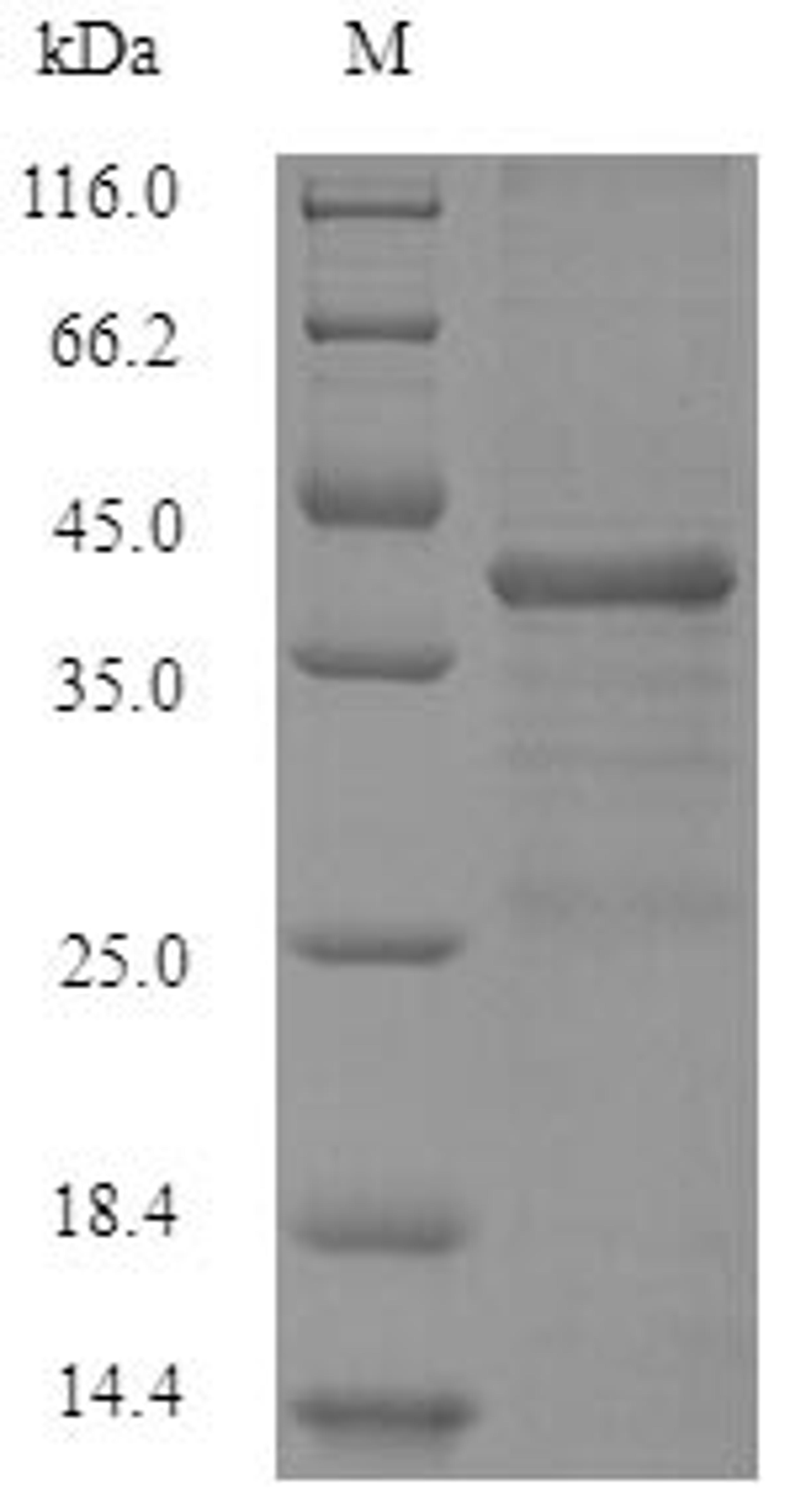 (Tris-Glycine gel) Discontinuous SDS-PAGE (reduced) with 5% enrichment gel and 15% separation gel.