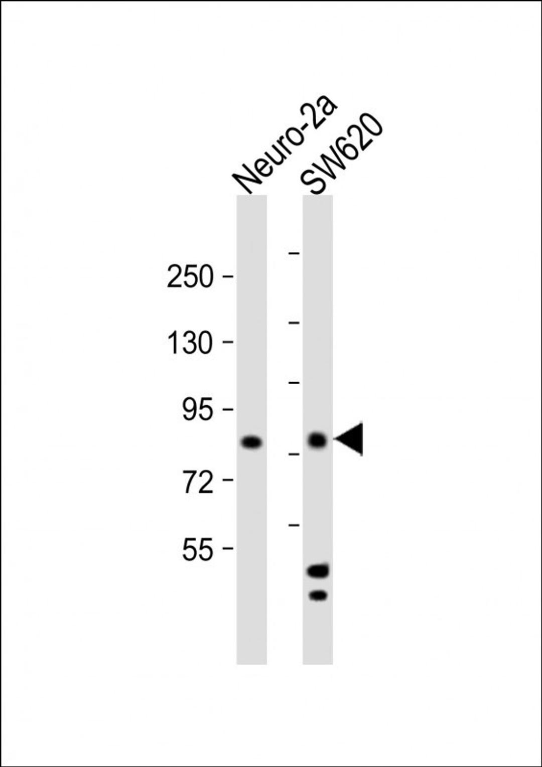 Western Blot at 1:2000 dilution Lane 1: Neuro-2a whole cell lysate Lane 2: SW620 whole cell lysate Lysates/proteins at 20 ug per lane.