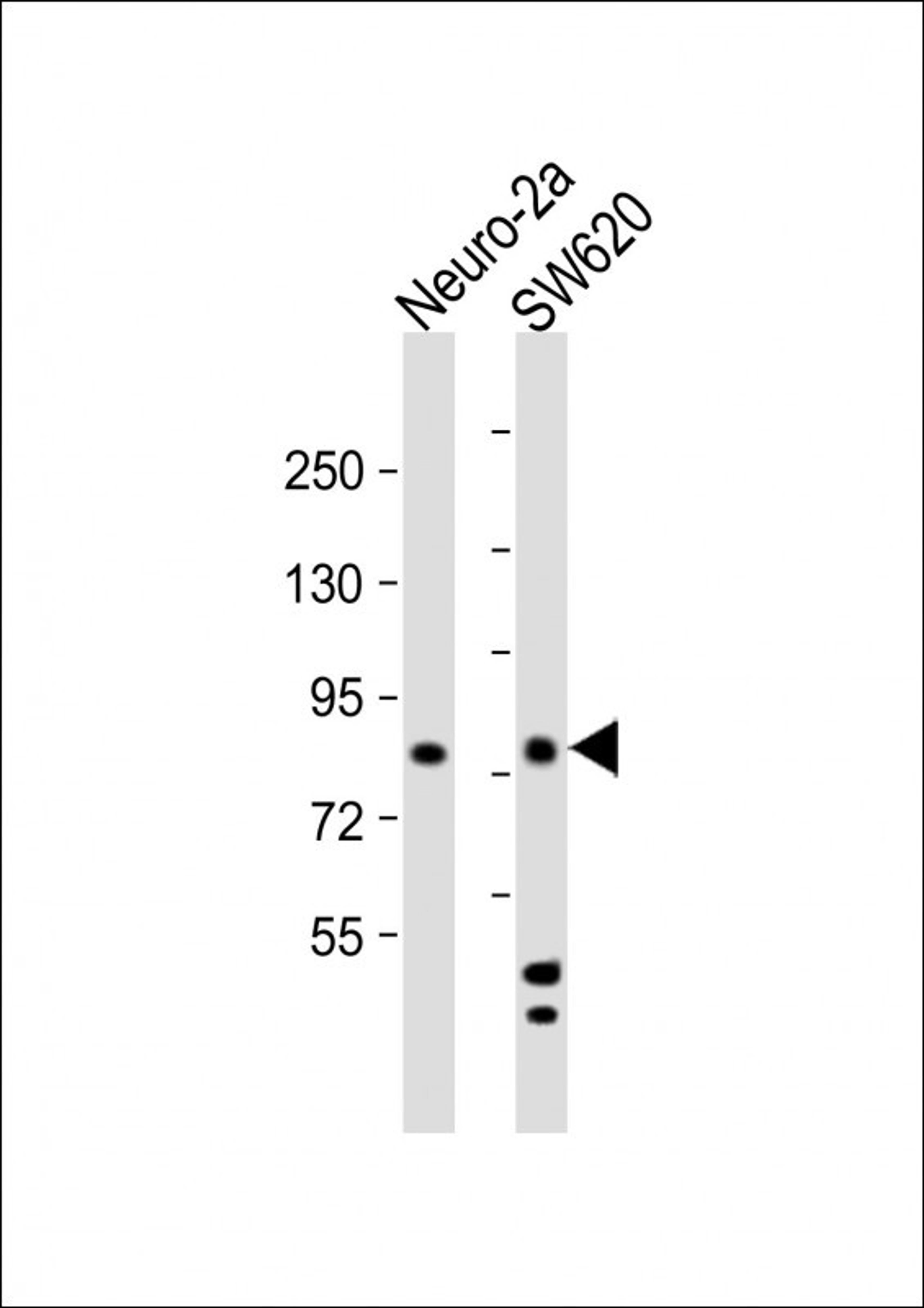 Western Blot at 1:2000 dilution Lane 1: Neuro-2a whole cell lysate Lane 2: SW620 whole cell lysate Lysates/proteins at 20 ug per lane.