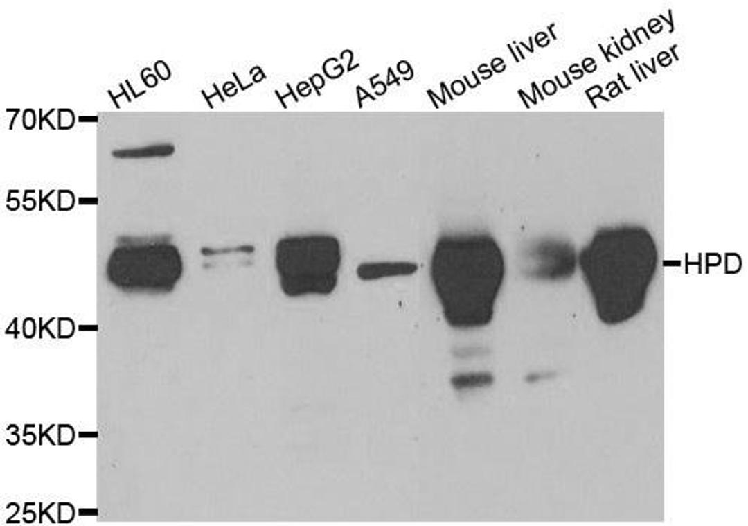 Western blot analysis of extracts of various cell lines using HPD antibody