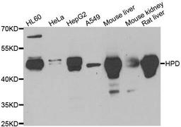 Western blot analysis of extracts of various cell lines using HPD antibody