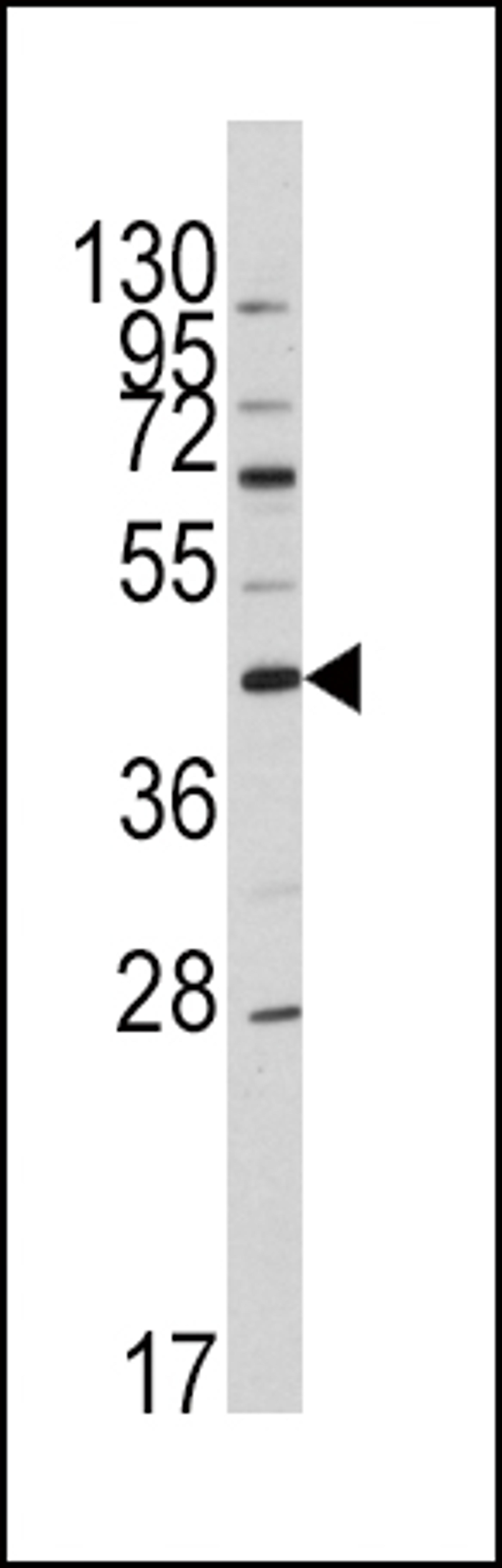 Western blot analysis of anti-APOA5 Antibody in HL60 cell line lysates (35ug/lane).