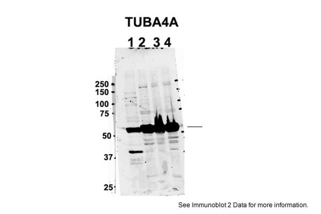 Antibody used in WB on Mouse Brain at 2 ug/ml.