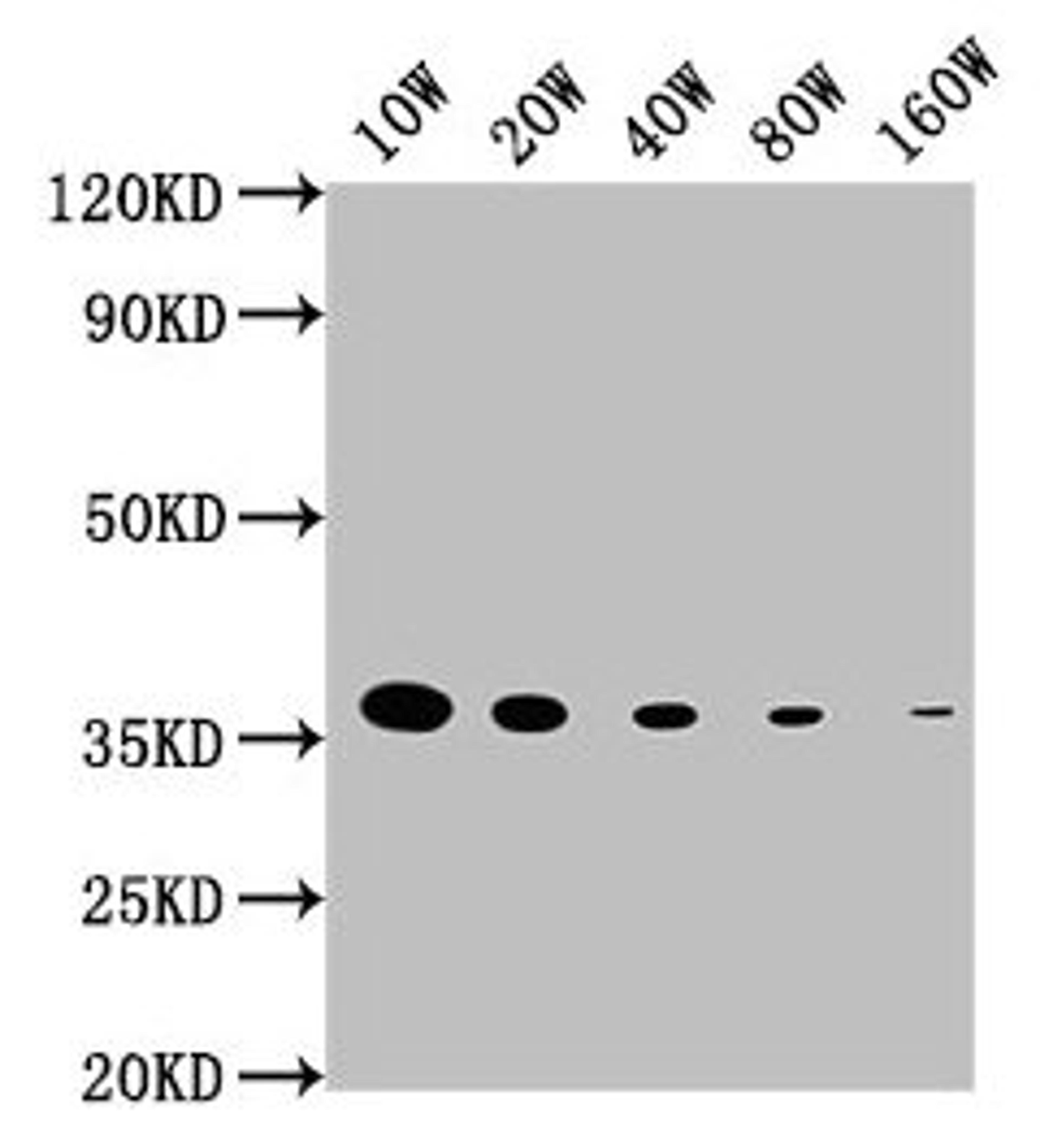 Western Blot. Positive WB detected in: 15ug hela whole cell lysate.  GAPDH antibody at 1:100000, 1:200000, 1:400000, 1:800000, 1:1600000. Secondary. Goat polyclonal to mouse IgG at 1/50000 dilution. Predicted band size: 36 KDa. Observed band size: 36 KDa. Exposure time: 5min. 