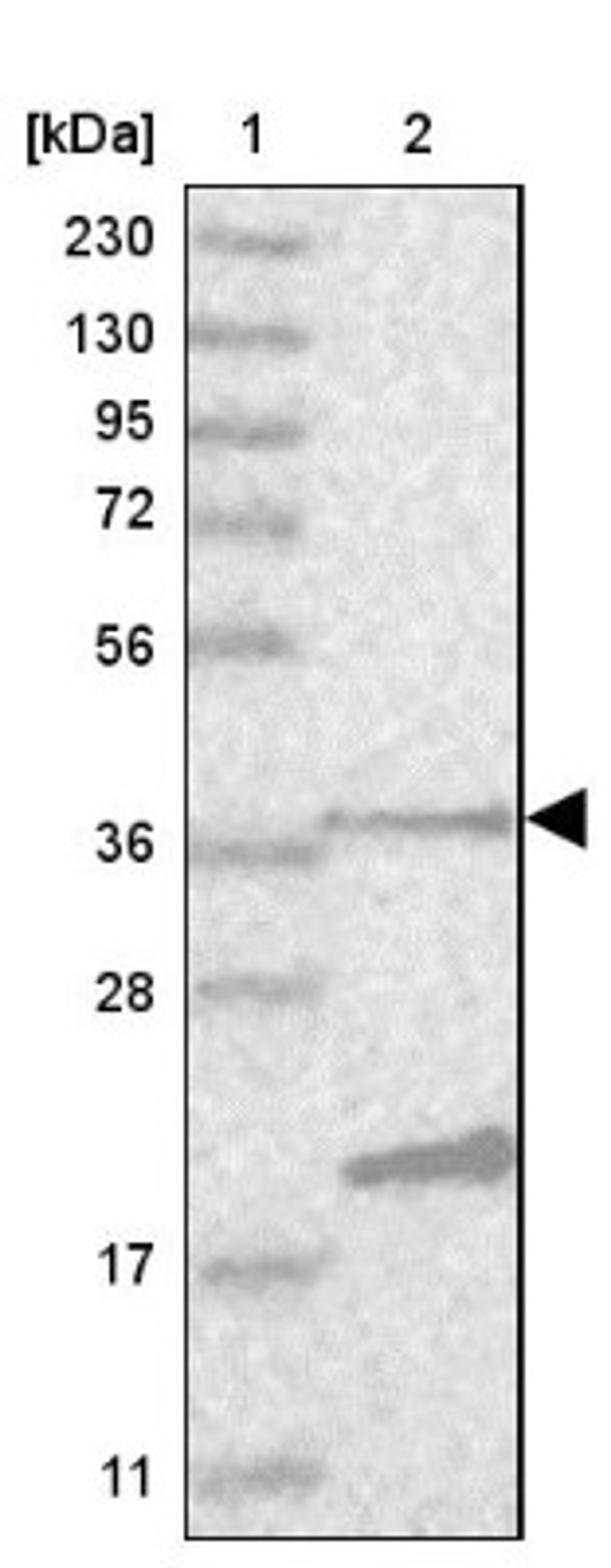 Western Blot: C2orf43 Antibody [NBP1-82135] - Lane 1: Marker [kDa] 230, 130, 95, 72, 56, 36, 28, 17, 11<br/>Lane 2: Human cell line RT-4