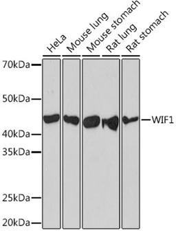 Western blot - WIF1 Rabbit mAb (A5171)