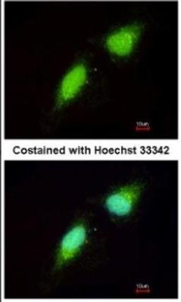 Immunocytochemistry/Immunofluorescence: NGFRAP1/BEX3/NADE Antibody [NBP1-31652] - Paraformaldehyde-fixed HeLa, using antibody at 1:200 dilution.