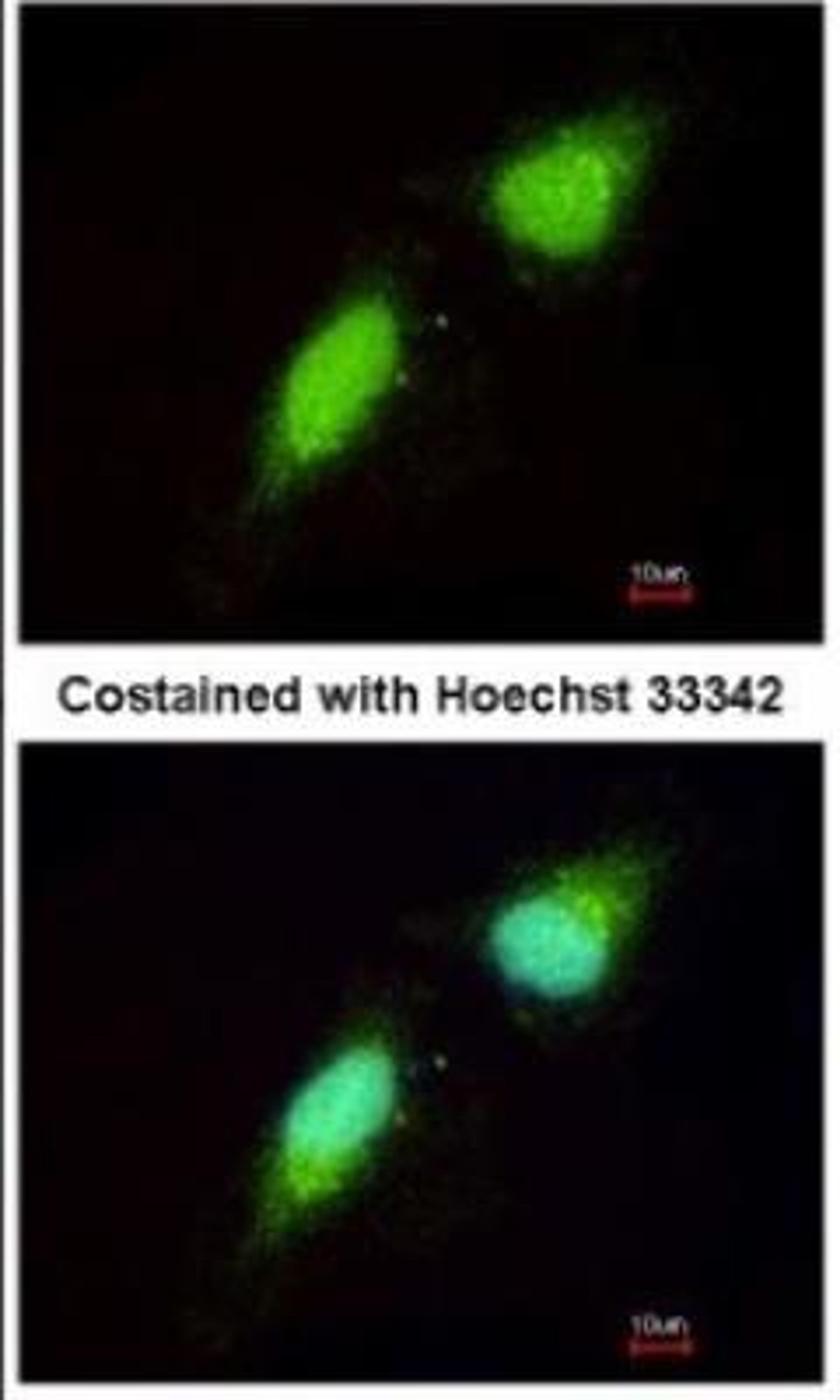 Immunocytochemistry/Immunofluorescence: NGFRAP1/BEX3/NADE Antibody [NBP1-31652] - Paraformaldehyde-fixed HeLa, using antibody at 1:200 dilution.