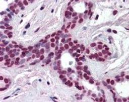 Immunohistochemistry staining of Cullin 3 in breast tissue using Cullin 3 Antibody.