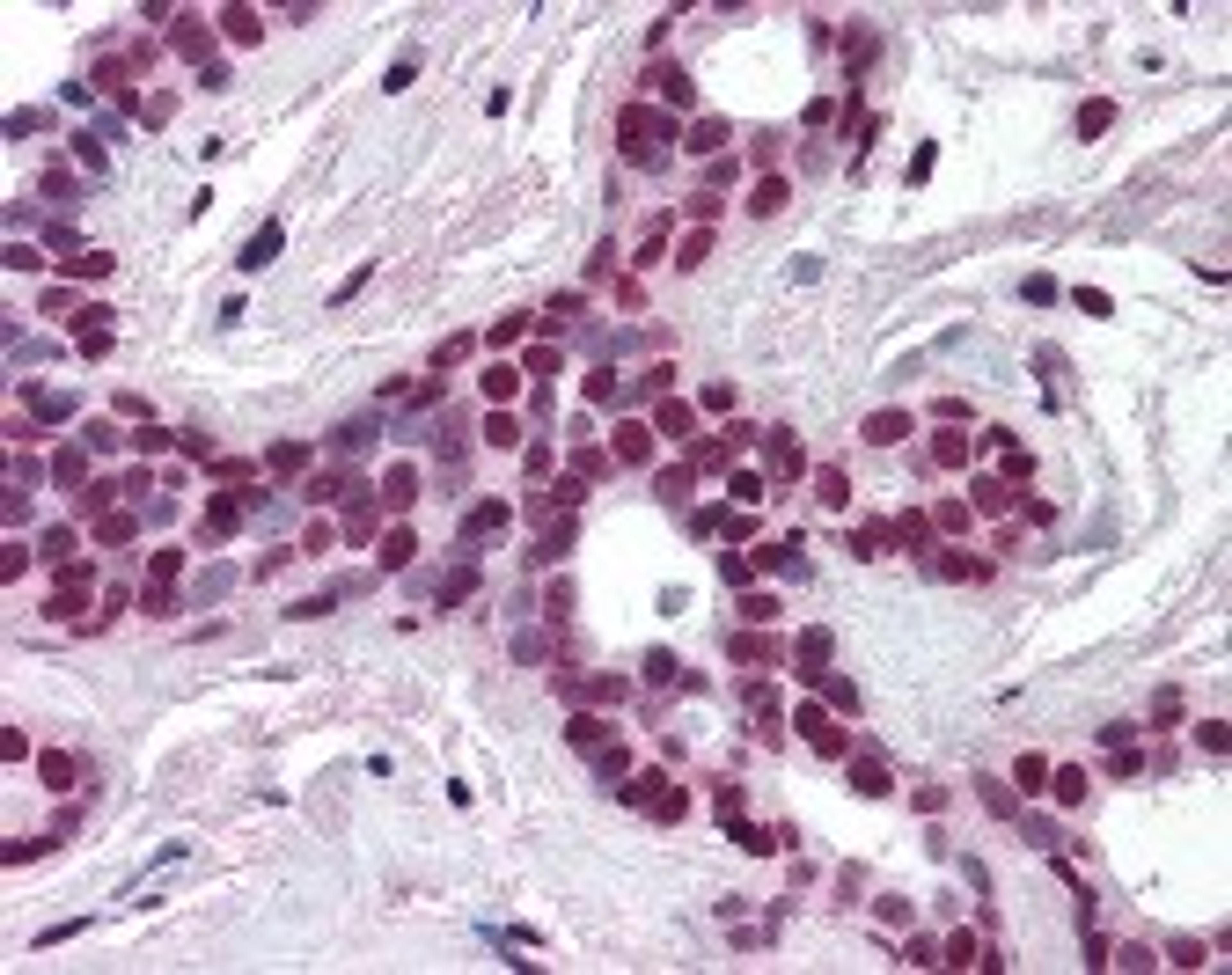 Immunohistochemistry staining of Cullin 3 in breast tissue using Cullin 3 Antibody.