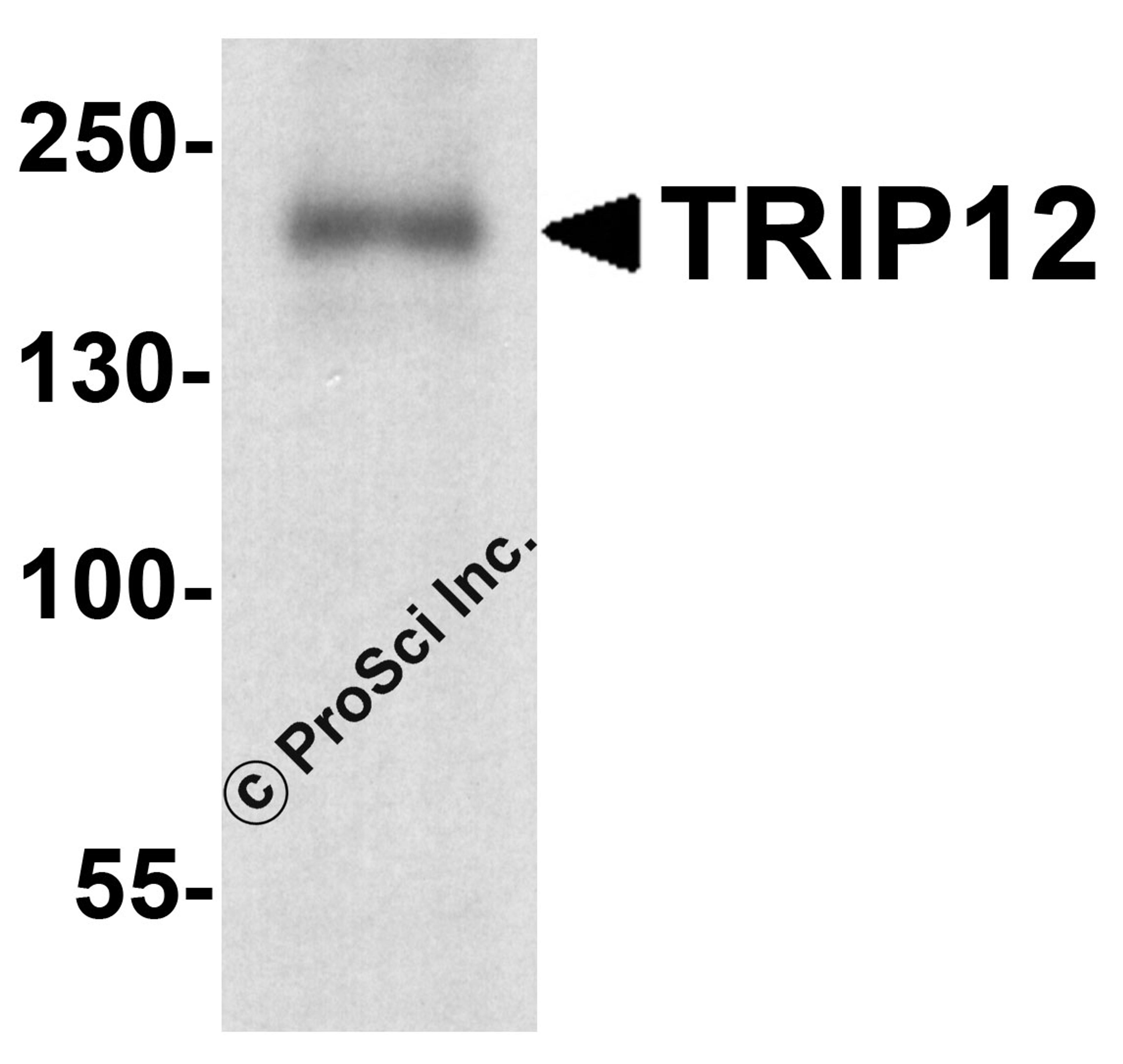 Western blot analysis of TRIP12 in rat colon tissue lysate with TRIP12 antibody at 1 μg/ml.