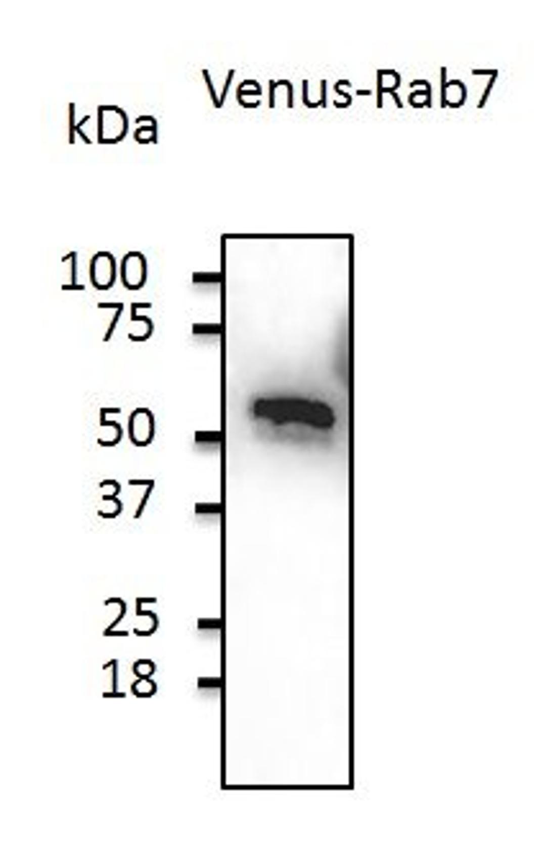 Western blot analysis of staining of IF 293HEK cells using Venus antibody